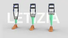 Le protesi low cost stampate in 3d del progetto Letizia