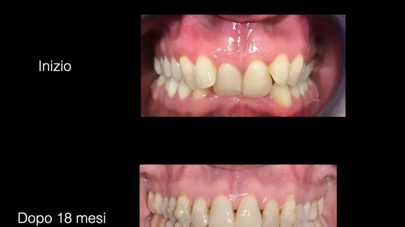 Un caso clinico affrontato con successo dallo studio