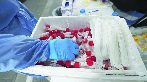 Tamponi per coronavirus raccolti in un hub - © www.giornaledibrescia.it