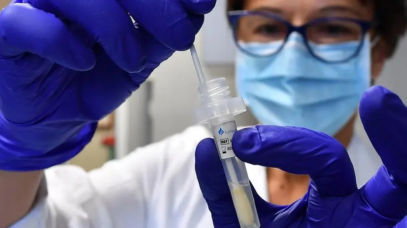 Secondo gli esperti i test antigenici sono poco affidabili per rilevare la Omicron - Foto © www.giornaledibrescia.it