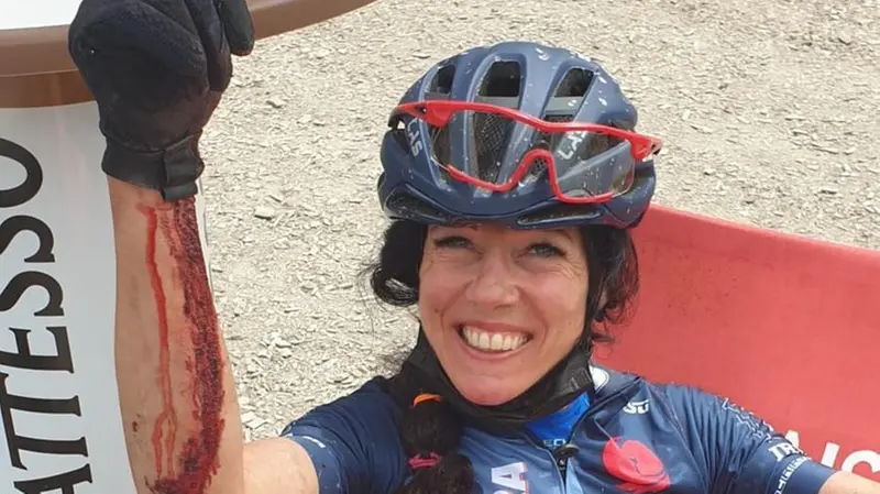 Anche qualche caduta: qui l’atleta Master con un braccio ferito - © www.giornaledibrescia.it