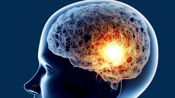 L’accumulo della proteina beta-amiloide nel cervello dei malati di Alzheimer