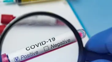 Il numero dei positivi al Sars-Cov-2 è pari a circa l’11% dei tamponi molecolari effettuati - © www.giornaledibrescia.it