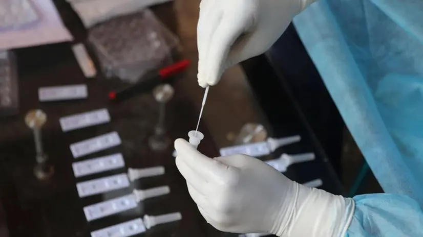 Test sierologici rapidi in un laboratorio d'analisi - Foto Ansa(Epa/Farooq Khan