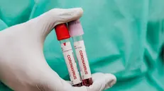 Test per il coronavirus - Foto © www.giornaledibrescia.it