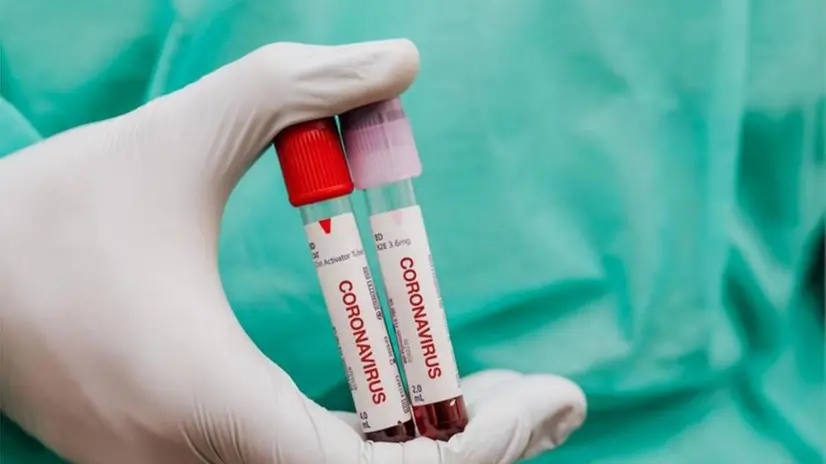 Test per il coronavirus - Foto © www.giornaledibrescia.it