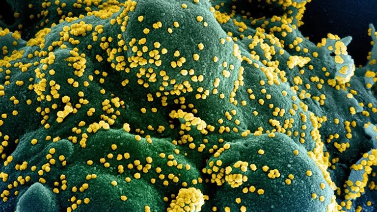 Il coronavirus al microscopio - © www.giornaledibrescia.it