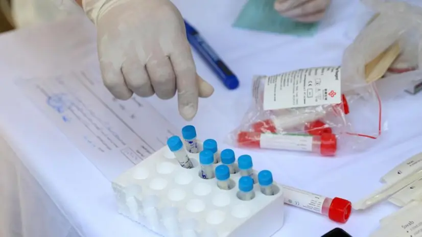 I contenitori per il prelievo del sangue - Foto © www.giornaledibrescia.it