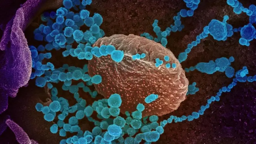 Il nuovo coronavirus (Sars-CoV-2) al microscopio -Foto Ansa/Epa © www.giornaledibrescia.it
