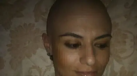 Una delle fotografie postate da Chiara Gandolfi durante la cura © www.giornaledibrescia.it