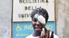 Daisy Osakue dopo le medicazioni in ospedale - Foto Ansa © www.giornaledibrescia.it