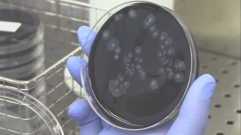 Le analisi in laboratorio per cercare il batterio - Foto © www.giornaledibrescia.it