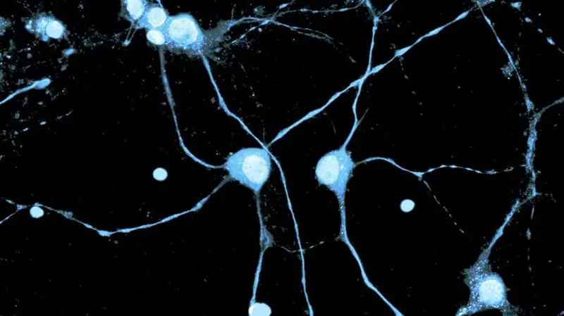 I neuroni dopaminergici della sostanza nera sono le cellule che degenerano nella Malattia di Parkinson - Foto  © www.giornaledibrescia.it