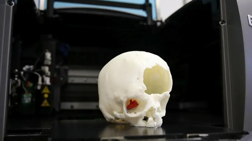 Il cranio stampato in 3D