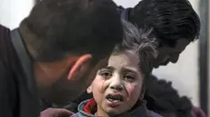 Un bambino rimasto ferito durante i bombardamenti - Foto Ansa/Epa Mohammed Badra