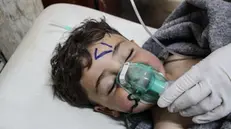 Un bambino riceve cure dopo il bombardamento a Idlib, in Siria - Foto Epa/Stringer