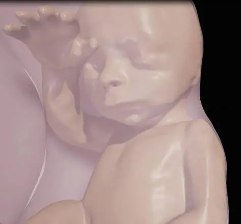 Modello in 3D di un feto  (fonte: Radiological Society of North America)