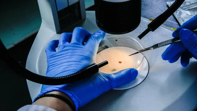 epa10790673 Cuban researcher Alejandro Cabezas Cruz dissects a tick to identify microbiota in a laboratory at the campus facilities of the ANSES (French Agency for Food, Environmental and Occupational Health and Safety) in Maisons Alfort, on the outskirts of Paris, France, 07 August 2023 (08 August 2023). Tick-borne pathogens can be passed to animals and humans by the bite of infected ticks with bacteria, viruses, or parasites. One major example of tick-borne disease is borreliosis (Lyme disease). A team of researchers from INRAE (National Research Institute for Agriculture, Food and Environment)??, in collaboration with ANSES and ENVA (National Veterinary School of Alfort), are proposing an innovative vaccine targeting the microbiota of ticks in order to reduce the prevalence of bacterium that causes the Lyme disease. There is still no human vaccine for the infection, however scientists are producing new medicines to fend off the illness.  EPA/TERESA SUAREZ