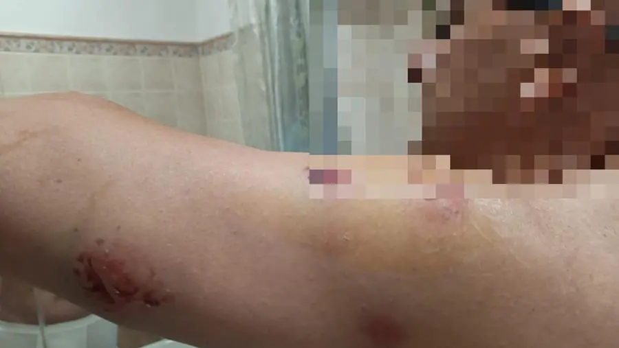 I segni dell'aggressione subita dal taxista © www.giornaledibrescia.it