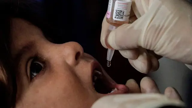 epa11577238 A nurse administers polio vaccine drops to a Palestinian child at at a United Nations school in Deir Al Balah town, southern Gaza Strip, on 01 September 2024. According to UNICEF, over 1.6 million doses of novel oral polio vaccine type 2 (nOPV2) will be delivered to the Gaza Strip as two rounds of a polio vaccination campaign are expected to be launched at the end of August and September 2024 across the Palestinian enclave to prevent the spread of circulating variant type 2 poliovirus (cVDPV2). WHO and UNICEF requested humanitarian pauses in the conflict to allow the vaccination campaign. The Palestinian Ministry of Health in collaboration with the World Health Organization (WHO), the United Nations Children's Fund (UNICEF), the United Nations Relief and Works Agency for Palestine Refugees (UNRWA) and partners, will provide two drops of nOPV2 to more than 640,000 children under ten years of age. The poliovirus was detected in July 2024 in environmental samples from Khan Younis and Deir al-Balah. EPA/MOHAMMED SABER