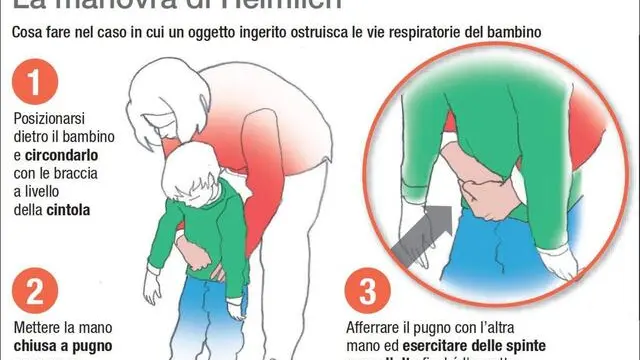 Come effettuare la manovra di Heimlich nei bambini per liberare le vie respiratorie ostruite da corpi estranei in un'infografica realizzata da Ansa-Centimetri, Roma, 29 maggio 2019. ANSA/CENTIMETRI