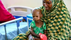 epa11138979 The 18-year-old daughter of Kulmia Abdu Issack (R), a mother of three internally displaced due to climate change, sits on her mother's lap on a hospital bed after being admitted with severe acute malnutrition and malaria complications, at the Dollow District Hospital, operated by Irish NGO Trocaire in Dollow, a border city between Somalia and Ethiopia, Jubaland state, Somalia, 29 January 2024 (issued 09 February 2024). After the worst drought in the last four decades that hit Somalia between 2020 and 2023, and the floods that followed, cases of malnutrition persist, not only due to lack of food, but also due to the consumption of unsafe water, which causes diarrhea in children, confirms Pamela Wasonga, nutritional coordinator in Somalia for the Irish NGO Trocaire. According to the latest provisional data from the Integrated Classification of the Phases of Food Security (IPC), to which Agencia EFE had access before its final publication in the coming weeks, some 440,000 minors in the country suffer from severe acute malnutrition, the deadliest form of hunger, a rise of 100,000 more compared to last September. EPA/DANIEL IRUNGU ATTENTION: This Image is part of a PHOTO SET