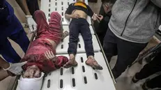 epa11773530 Wounded Palestinian children lie on a stretcher upon their arrival to the al-Aqsa Martyrs Hospital in Deir al-Balah, central Gaza Strip, 12 December 2024. According to the Palestinian Ministry of Health in Gaza, at least 25 people were killed in an Israeli airstrike on the Nuseirat refugee camp in central Gaza Strip. More than 45,000 Palestinians and over 1,400 Israelis have been killed, according to the Palestinian Health Ministry and the Israeli Army, since Hamas militants launched an attack against Israel from the Gaza Strip on 07 October 2023, and the Israeli operations in Gaza and the West Bank which followed it. EPA/MOHAMMED SABER