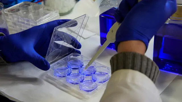 epa09625547 A scientist work at the laboratory of the company Laminar Pharma in Palma de Mallorca, Balearics, Spain, 25 November 2021 (issued 06 December 2021). The antitumor drug LAM561, in the last and final phase of human testing before being marketed, has been developed in the laboratory of the Mallorcan biotechnology company Laminar Pharma and may represent a "revolution" for the treatment of gliobastoma, which causes one of each three brain cancers and whose life expectancy is one year. EPA/CATI CLADERA