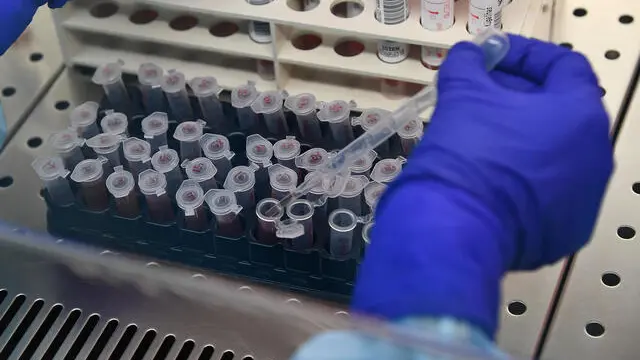 Un dottore processa i tamponi test Covid-19 effettuati sui pazienti, nel laboratorio del Policlinico S.Martino. Genova, 26 Maggio 2020 ANSA/LUCA ZENNARO