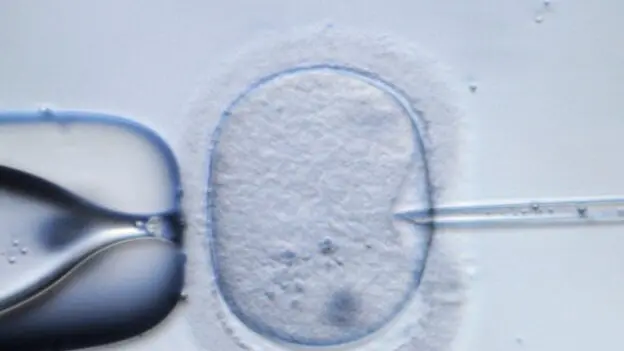 epa02373394 (FILE) - A file picture dated 09 February 2009 shows a human egg cell being injected for demonstration purposes at a laboratory in Dresden, Germany. British researcher Robert Edwards, pioneer of in vitro fertilization, won this year‘s Nobel Prize for Medicine, it was announced in Stockholm on 04 October 2010. Edwards‘ research has "made it possible to treat infertility, a medical condition afflicting a large proportion of humanity including more than 10 per cent of all couples worldwide," the Nobel Assembly said. EPA/RALF HIRSCHBERGER