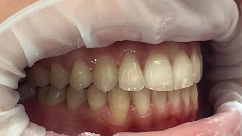 Prima e dopo: anche esteticamente il risultato finale è evidente