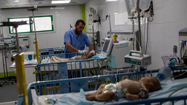 epa11467376 Palestinian children suffering from malnutrition are treated at Nasser Hospital in Khan Yunis, southern Gaza Strip, 08 July 2024. According to the UN, famine is 'imminent' in Gaza as half of its population, 1.1 million people, faces 'catastrophic food insecurity' due to the conflict and restrictions on humanitarian access. Children's acute malnutrition rates have rapidly increased, with one in three children under two years of age suffering from malnutrition. Since 07 October 2023, up to 1.7 million people, or more than 75 percent of the population, have been displaced throughout the Gaza Strip, some more than once, in search of safety, according to the United Nations Relief and Works Agency for Palestine Refugees in the Near East (UNRWA). The World Health Organization (WHO) stated that Palestinians in Gaza constitute around the 80 percent of all people facing famine worldwide. EPA/HAITHAM IMAD