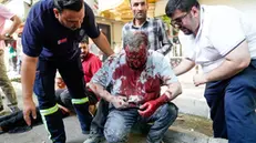 epa12177679 People help a wounded man following an Israel airstrike in central Tehran, Iran, 15 June 2025. Israel and Iran have been exchanging fire since Israel attacked Iran on 13 June 2025 as part of operation 'Rising Lion'. EPA/AMIR KHOLOUSI