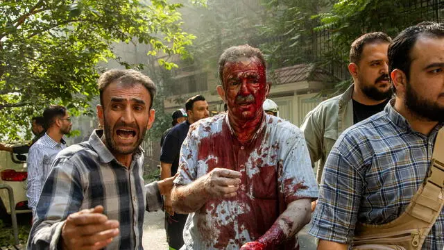 epa12177678 People help a wounded man following an Israel airstrike in central Tehran, Iran, 15 June 2025. Israel and Iran have been exchanging fire since Israel attacked Iran on 13 June 2025 as part of operation 'Rising Lion'. EPA/MAJID KHAHI
