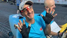Michele Cibaldi con le mani ustionate
