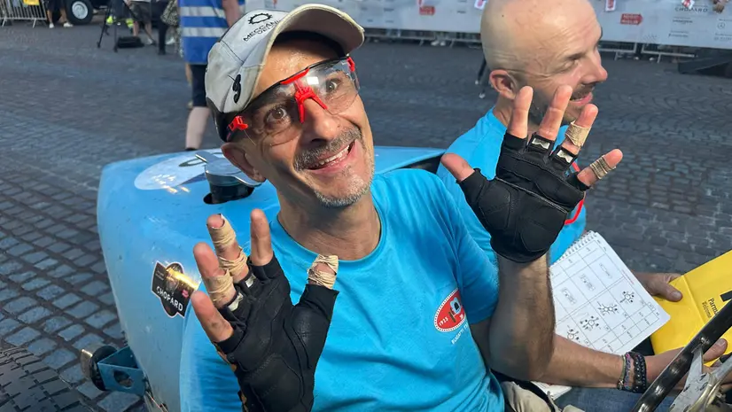 Michele Cibaldi con le mani ustionate