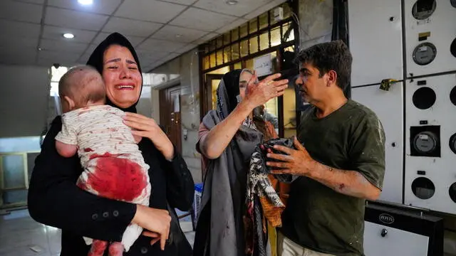 epa12177680 Wounded people react following an Israel airstrike in central Tehran, Iran, 15 June 2025. Israel and Iran have been exchanging fire since Israel attacked Iran on 13 June 2025 as part of operation 'Rising Lion'. EPA/AMIR KHOLOUSI