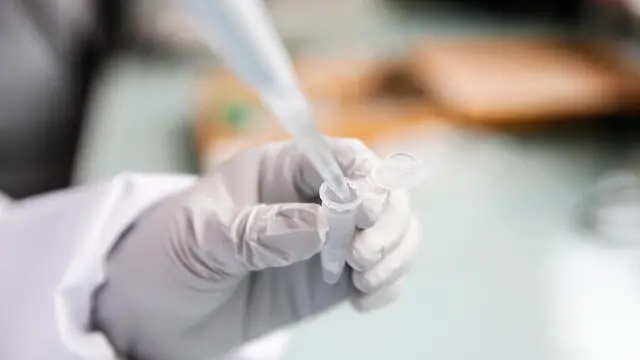 epa10790667 Paraguayan researcher Alejandra Wu-Chuang uses a pipette for antibody detection in a laboratory at the campus facilities of the ANSES (French Agency for Food, Environmental and Occupational Health and Safety) in Maisons Alfort, on the outskirts of Paris, France, 07 August 2023 (08 August 2023). Tick-borne pathogens can be passed to animals and humans by the bite of infected ticks with bacteria, viruses, or parasites. One major example of tick-borne disease is borreliosis (Lyme disease). A team of researchers from INRAE (National Research Institute for Agriculture, Food and Environment)​​, in collaboration with ANSES and ENVA (National Veterinary School of Alfort), are proposing an innovative vaccine targeting the microbiota of ticks in order to reduce the prevalence of bacterium that causes the Lyme disease. There is still no human vaccine for the infection, however scientists are producing new medicines to fend off the illness. EPA/TERESA SUAREZ
