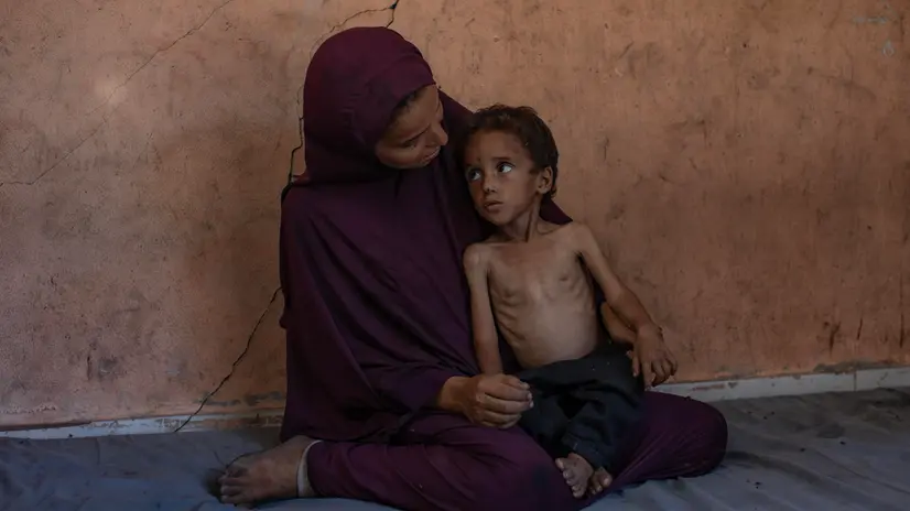 epa12247635 Palestinian child Yazan Abu Foul, aged two, is cared for by his mother Naima, as he suffers from severe malnutrition due to the acute shortage of food caused by the blockade imposed on the Gaza Strip and the closure of border crossings, in Al-Shati refugee camp, west of Gaza City, 19 July 2025. Yazan lives in harsh environmental and health conditions, with his family lacking the basic necessities of life amid a worsening humanitarian crisis. According to medical sources, the child’s health continues to deteriorate due to the lack of proper nutrition and necessary medical care. Humanitarian organizations have warned of an imminent food catastrophe threatening the lives of thousands of children in the besieged Gaza Strip, this situation coming at a time when Gaza’s residents face severe food insecurity and a sharp decline in health services, amid ongoing restrictions on the entry of humanitarian aid and essential supplies. EPA/HAITHAM IMAD