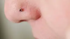 PIERCING AL NASO ROVINA VISO A UNA 14ENNE DI NAPOLI (ANSA) - NAPOLI, 8 GIU - Un'infezione dopo un piercing al naso causata da un batterio stafilicocco aureo ha rovinato il viso di una quattordicenne. E' accaduto a Napoli dove la ragazzina deve ora sottoporsi ad interventi di chirurgia plastica per ricostruirle il naso.