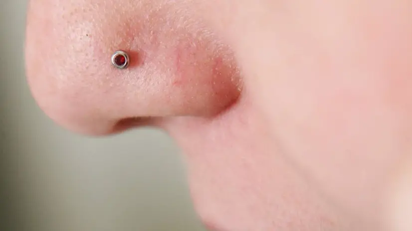 PIERCING AL NASO ROVINA VISO A UNA 14ENNE DI NAPOLI (ANSA) - NAPOLI, 8 GIU - Un'infezione dopo un piercing al naso causata da un batterio stafilicocco aureo ha rovinato il viso di una quattordicenne. E' accaduto a Napoli dove la ragazzina deve ora sottoporsi ad interventi di chirurgia plastica per ricostruirle il naso.