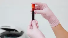Un prelievo di sangue