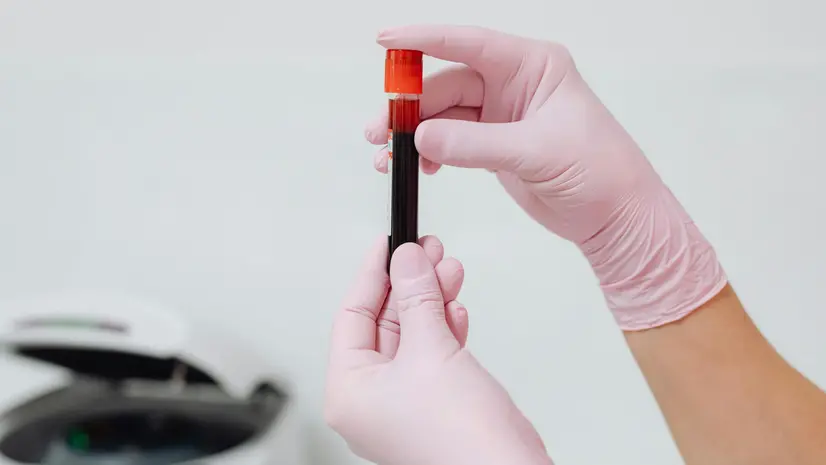 Un prelievo di sangue