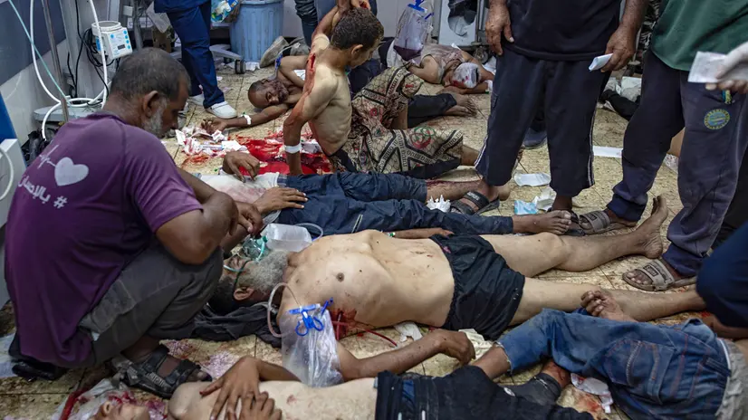 epa12284565 GRAPHIC CONTENT - Wounded Palestinians are treated at Nasser Hospital in Khan Younis, Gaza Strip, 05 August 2025. According to the hospital, hundreds of patients were being treated following Israeli bombardements on a near-by area. EPA/HAITHAM IMAD -- ATTENTION EDITORS: GRAPHIC CONTENT --