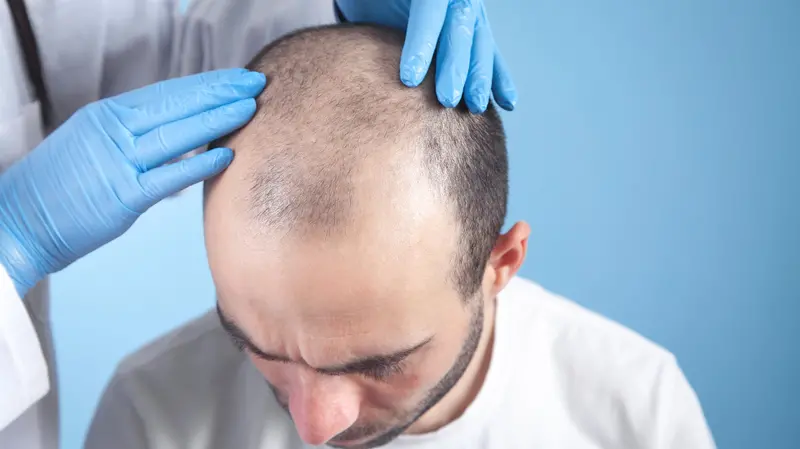 Doctor hands on patient head. Hair growth