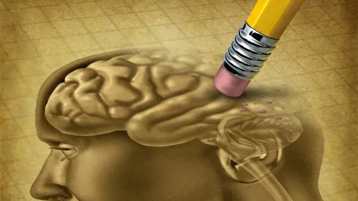 L'Alzheimer è una malattia che ruba i ricordi