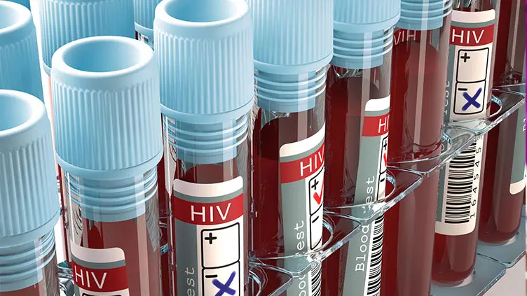 Dato delle infezioni stabile - © www.giornaledibrescia.it