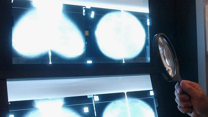 Uno screening alla mammella - © www.giornaledibrescia.it