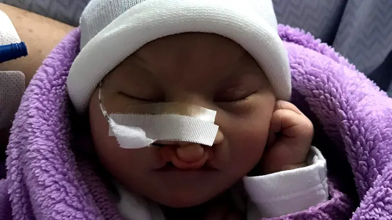 La piccola ha vissuto 46 ore © www.giornaledibrescia.it