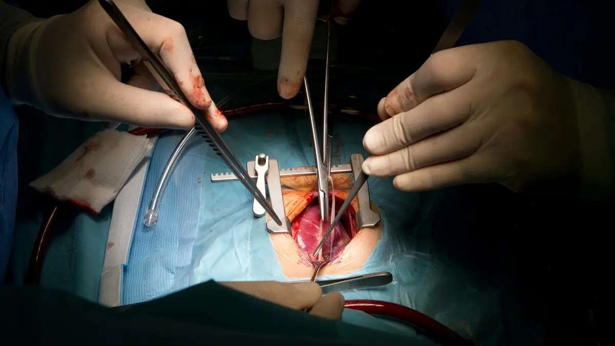 Un'operazione a cuore aperto
